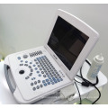 Échographe ultrasonique d&#39;ordinateur portable d&#39;équipement d&#39;ultrason de DW-500